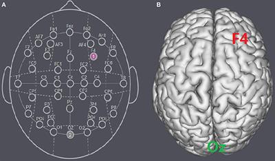 Enhancing the Activity of the DLPFC with tDCS Alters Risk Preference without Changing Interpersonal Trust